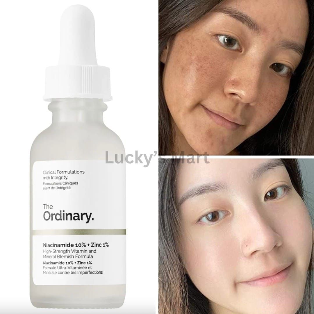 Niacinamide 10 % +zinc 1 %