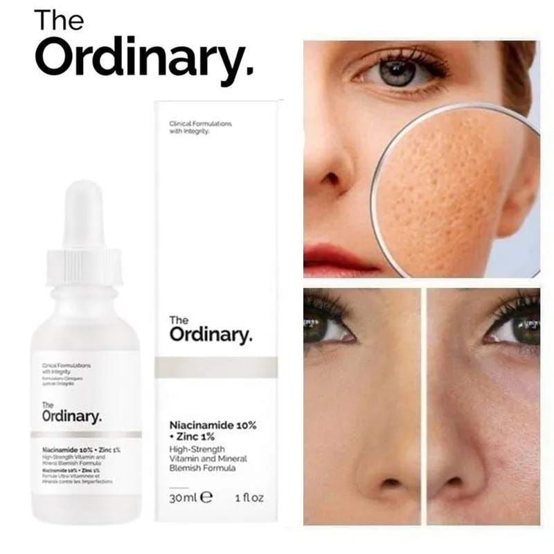 Niacinamide 10 % +zinc 1 %
