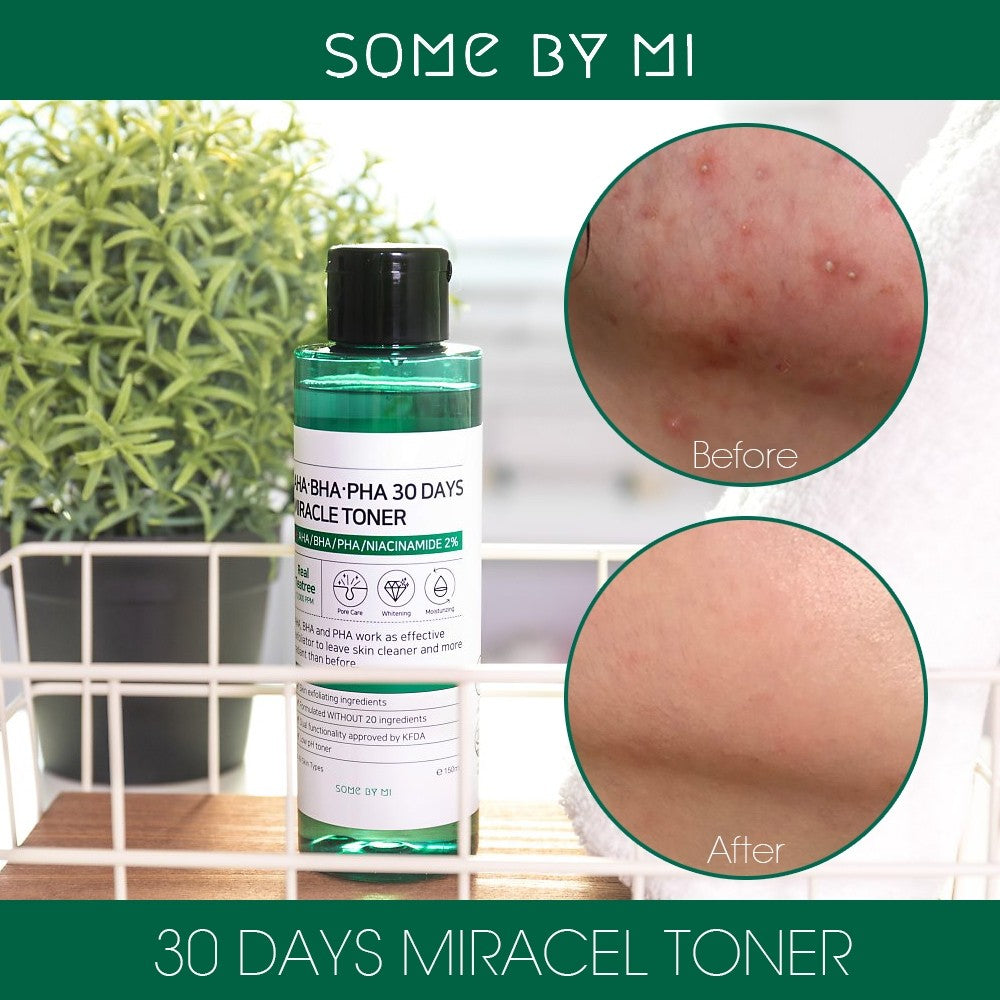 AHA BHA PHA 30 DAYS MIRACLE TONER