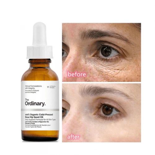 Caffeine solution 5% + EGCS
