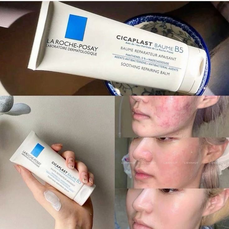EFFACLAR DUO ( +)