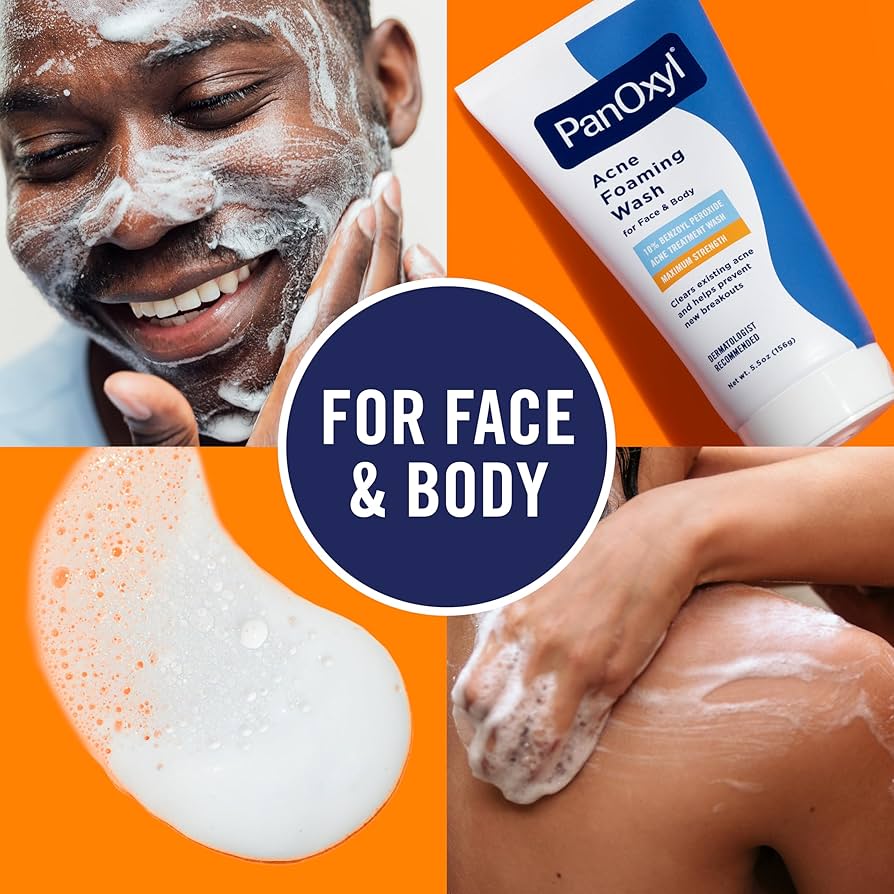 Acne foaming wash