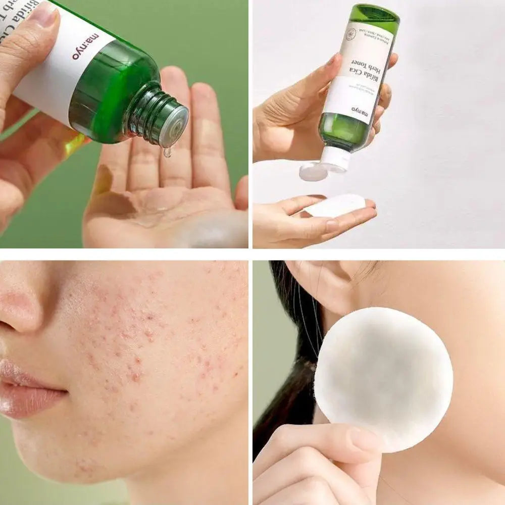 Bifida cica herb toner