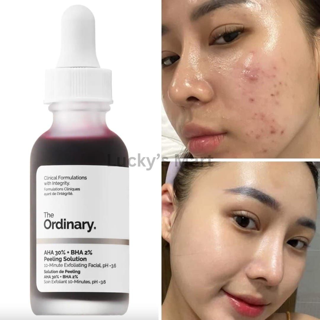 PHA 30 % + BHA 2 % peeling solution